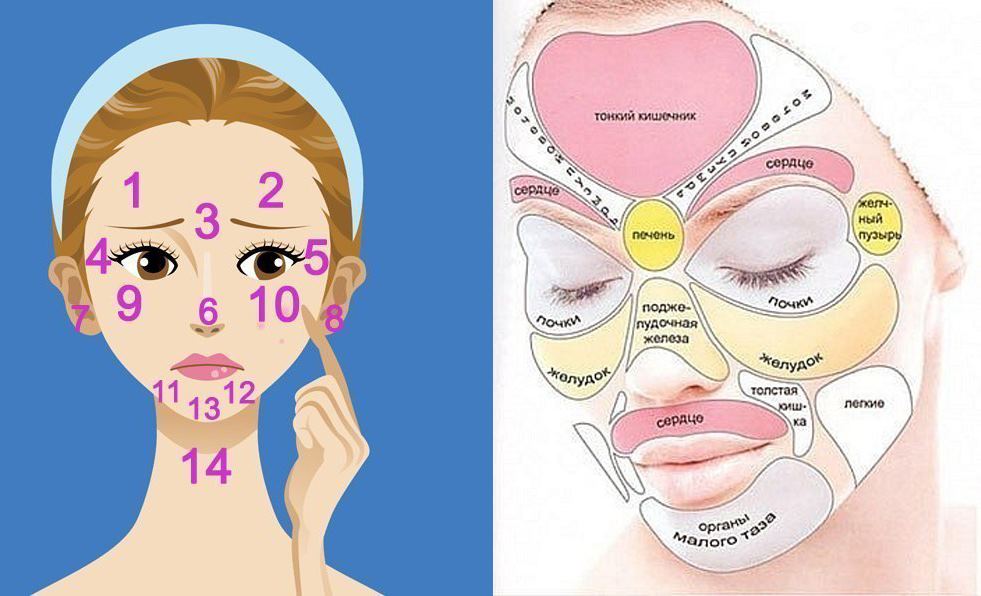 Прыщи на лице: О каких заболеваниях предупреждает кожа